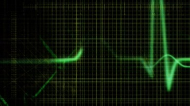 绿色荧光波形心电图视频素材
