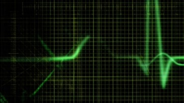 绿色光波心电医疗仪器视频素材