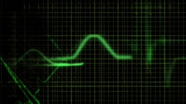 绿色光波心电医疗仪器视频素材