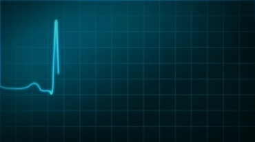 心率跳动波形图监护仪显示心跳视频素材
