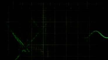 绿色波形跳动心脏监护仪医疗仪器视频素材