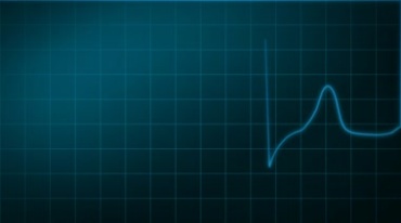 示波器心脏跳动心率波形图视频素材
