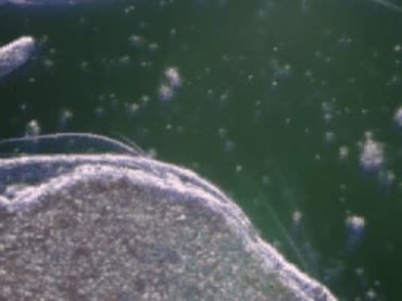 细菌病菌病毒样本显微镜观察视频素材