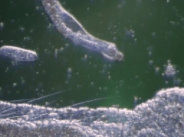 细菌病菌病毒样本显微镜观察视频素材