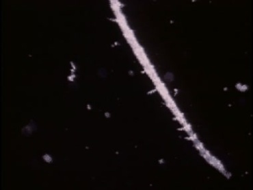 显微镜下微生物线虫病毒细菌病菌视频素材