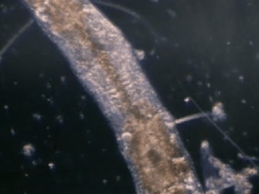 病毒病菌细菌病原体显微镜放大观察视频素材