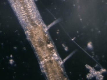病毒病菌细菌病原体显微镜放大观察视频素材