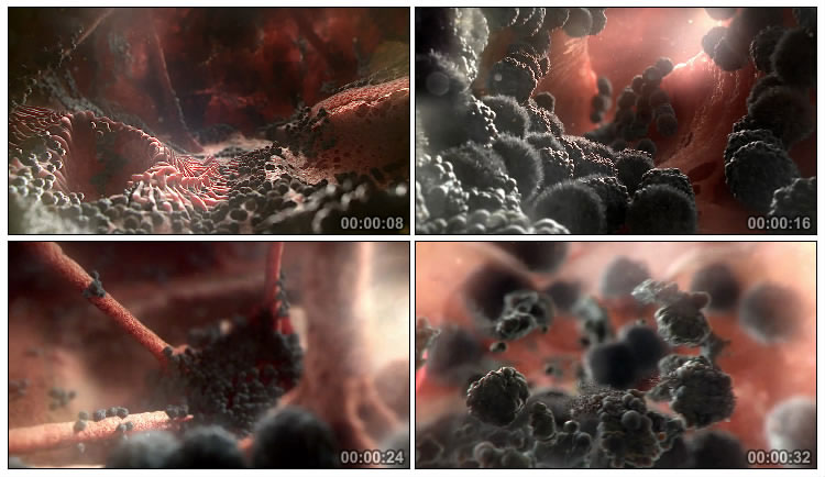 体内病毒癌细胞模拟动画